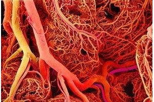 驳斥谣言经常吃黑木耳、洋葱就可以整理血管废物今天才知道本相