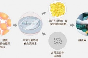 北京脂肪界导师研究奥美定和生长因子区别的危害