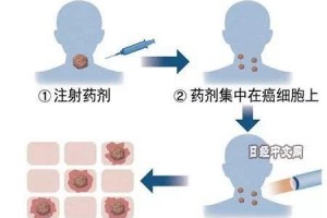 癌症治疗的第5条道路在显现