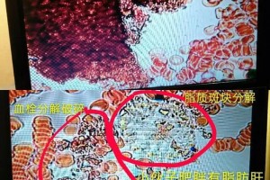 肝脏动过手术的人可以喝酵素么?会对身体造成危害吗