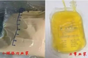 真相快餐店越多的地区心脏病发作越多