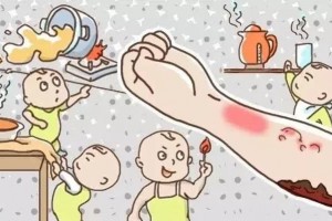 2岁女童掉进热油锅情急之下爸妈这个动作更……