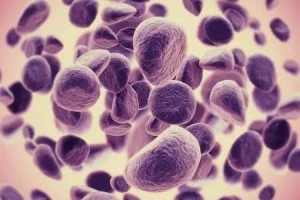 细胞阻止肿瘤恶性转移科学家找到破解癌症杀手锏的新靶点
