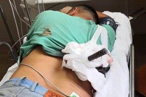 男子高空坠落被60厘米长钢筋贯穿胸腹医生消防员合力抢救