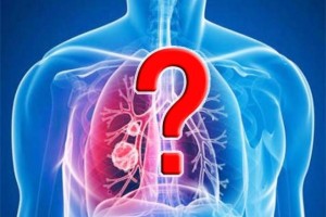 什么样的肺结节是肺癌6类人要小心发现结节这样做才安心