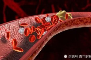 女儿一句好心叮嘱竟要了60岁妈妈的命这个错误你也可能常犯