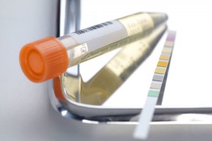 尿酸不是忽然升高的勤做2件事不让痛风找上门
