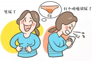 女性尿失禁最佳预防期是产后42天~半年内还有现在