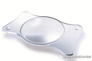 全程视力优化生活我院眼科成功开展三焦点人工晶体