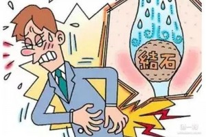 预防肾结石当从科学补钙做起