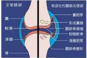 再生医学技术--间充质干细胞/膝关节退行性病变