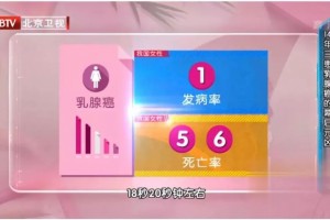 关于内衣很多女孩子都买错了医生告诉你挑选原则
