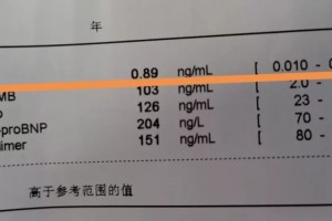 长假前定焦大叔亲眼目睹一台急诊所有人都应该看看提个醒