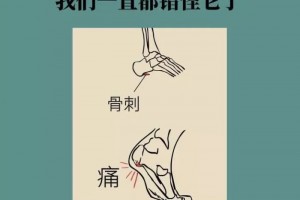 骨刺竟然是好东西我们一直都错怪它了