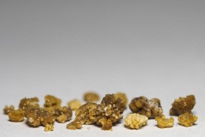 肾结石是怎么形成的医生劝告这5类食物真的不要多吃
