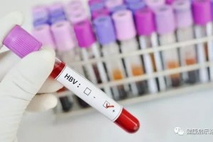 乙肝可以几乎100％治愈做好这4件事未尝没有自愈可能