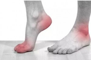 为何痛风趋年轻人屡中痛风的原因竟是这个3招教你远离它