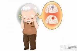 短暂脑缺血发作
