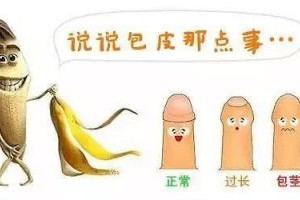 包皮过长咋会和艾滋病有关系文末有惊喜