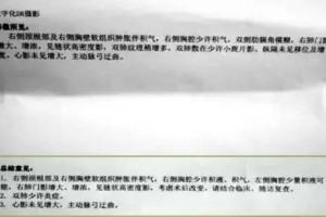 典型案例集肺术后大多患者格外敏感他们遇到的问题你也有吗