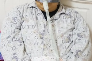 小伙心脏比常人胖1倍险丢命医生想救命先减肥