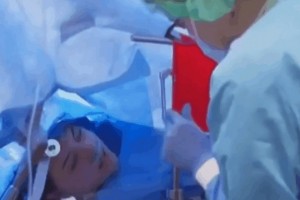 女医学生浅笑直播开颅手术认识清醒一向说话继续近45分钟