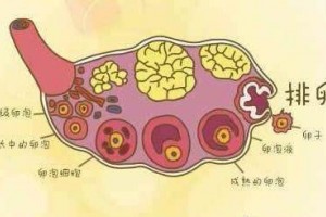 排卵妨碍是不是没有卵泡存在还能怀孕吗