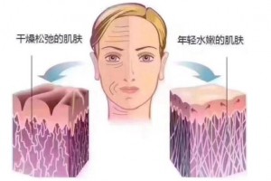 干性肌肤为何会干?你会归于哪一个