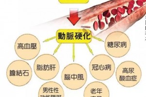 这种生果能降压降脂还能调度胃胀积食却很少有人吃