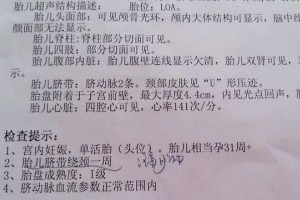 孕期的这2行为可能会让胎儿被绑娃出世后的姿态真让人疼