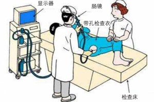 服用阿司匹林无法切息肉医师只需留意停药时刻就能确保安全