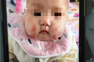 名为营养素实践是饮料婴儿当奶粉吃俩月全身浮肿还悲伤