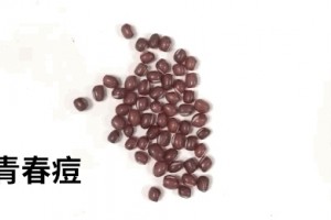 黑头贴小气泡都不能去黑头医师只引荐两种斩草除根的办法