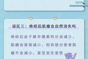 图解子宫肌瘤常见误区你必定要知道