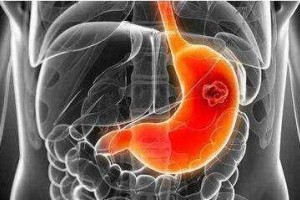 胃病三分治七分养日子中有这4个养胃小好方法渐渐养胃作用好