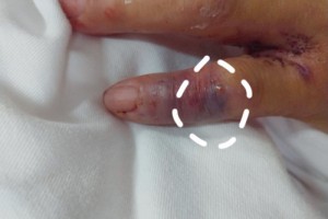 可怕福建一男人杀鱼时手被刺伤竟不幸离世